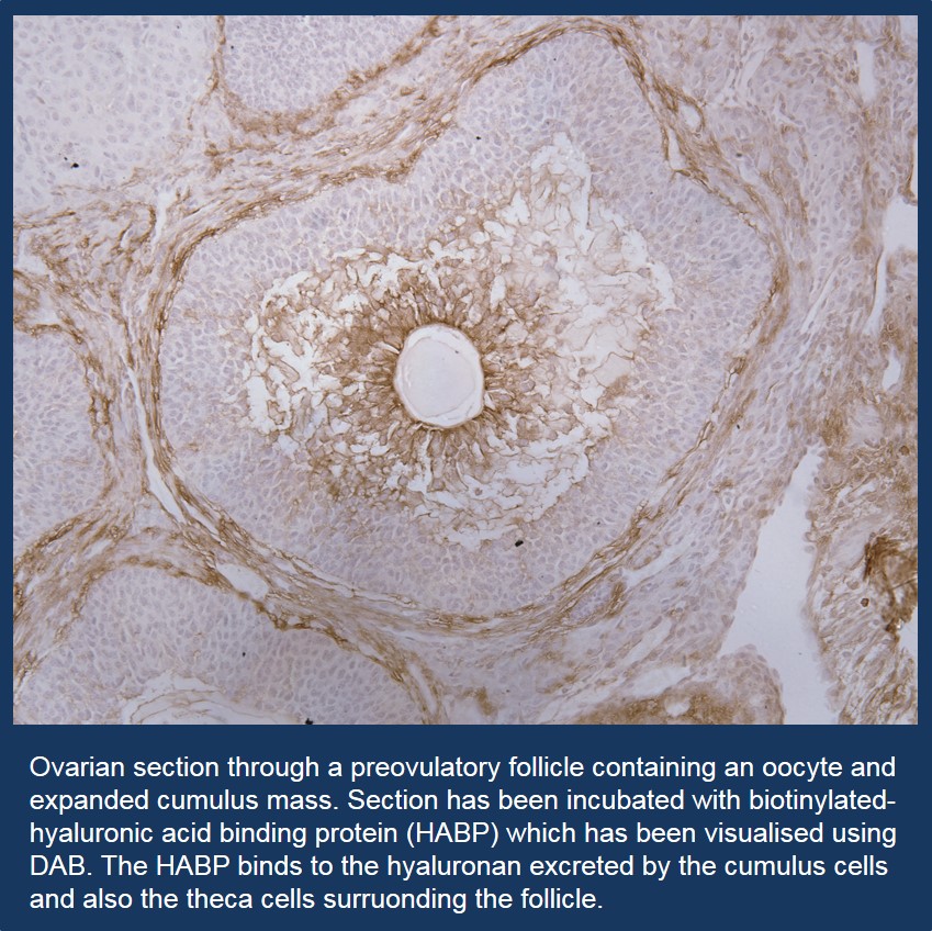 Ovarian section through a preovulatory follicle