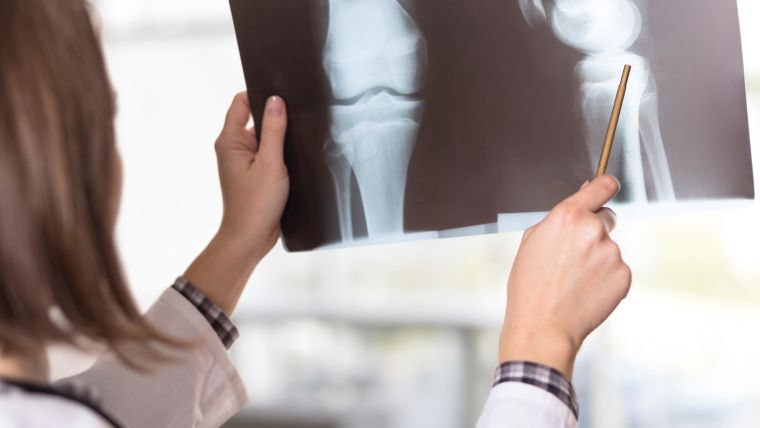 Further research into the relationship between brittle bones and women's heart disease risk could be beneficial suggest Drs Dexter Canoy and Kazem Rahimi at the Nuffield Dept of Women's & Reproductive Health.