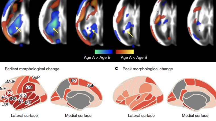 First Digital Fetal Brain Atlas Unveiled